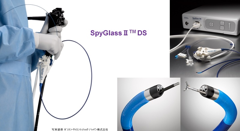 SpyGlassⅡ™DS①